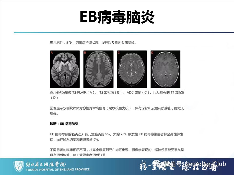 影像PPT - 【PPT】双侧基底节病变的影像诊断和鉴别诊断-144