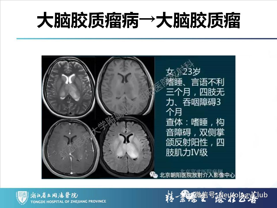 影像PPT - 【PPT】双侧基底节病变的影像诊断和鉴别诊断-159