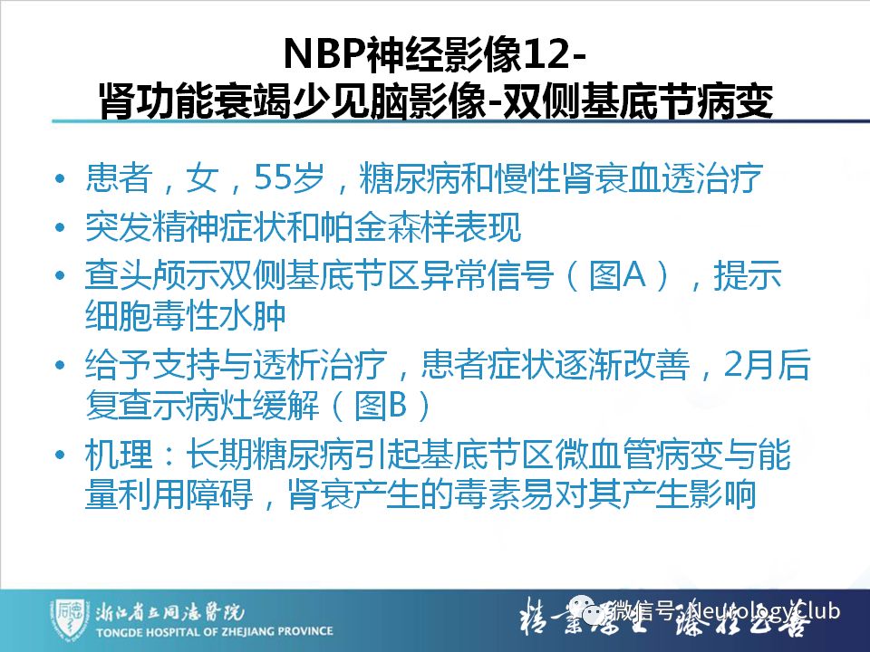 影像PPT - 【PPT】双侧基底节病变的影像诊断和鉴别诊断-184