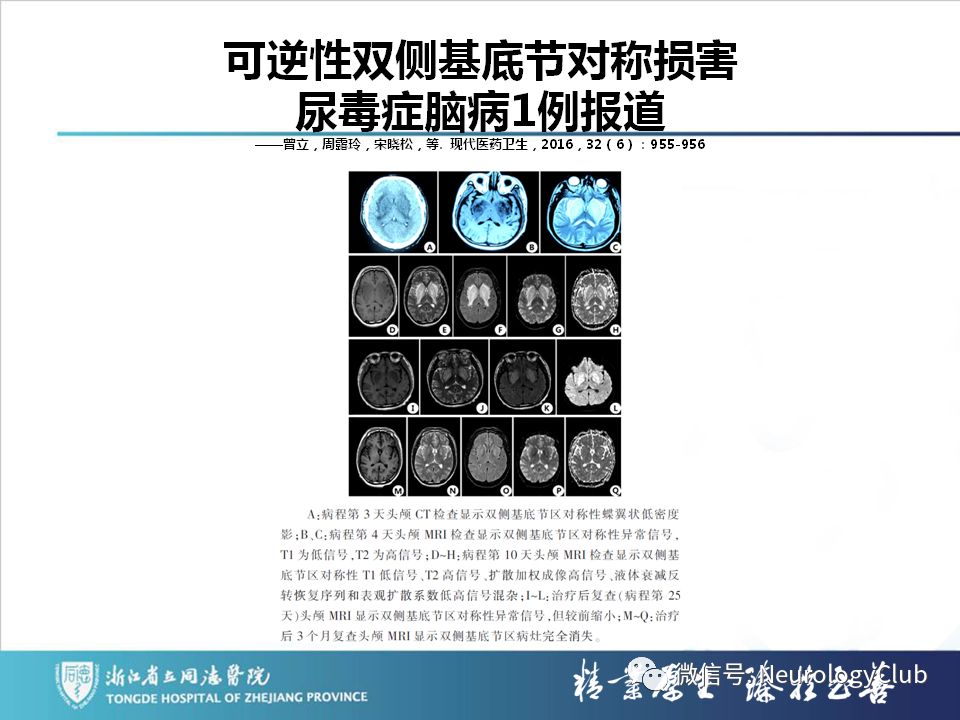 影像PPT - 【PPT】双侧基底节病变的影像诊断和鉴别诊断-190