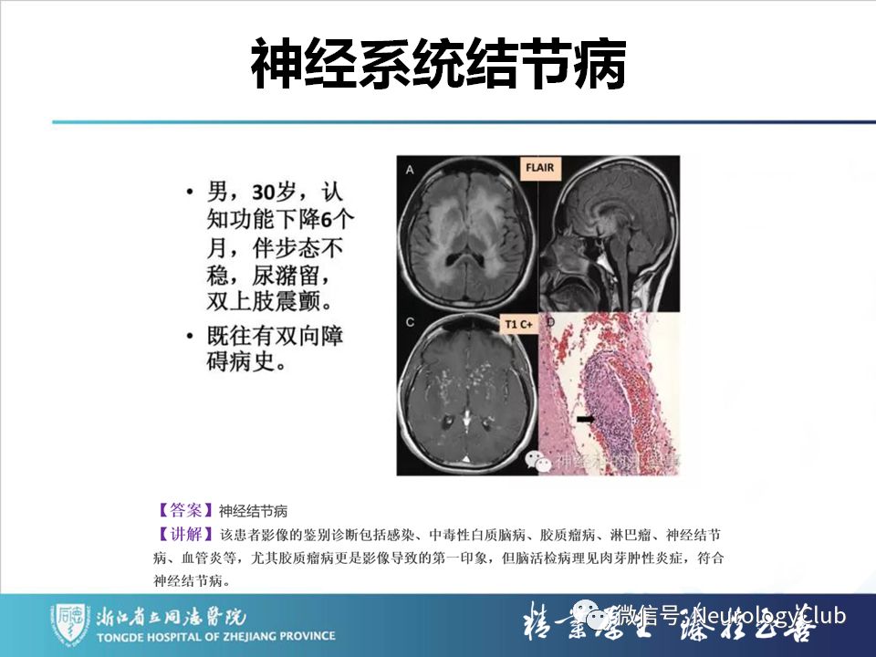 影像PPT - 【PPT】双侧基底节病变的影像诊断和鉴别诊断-192