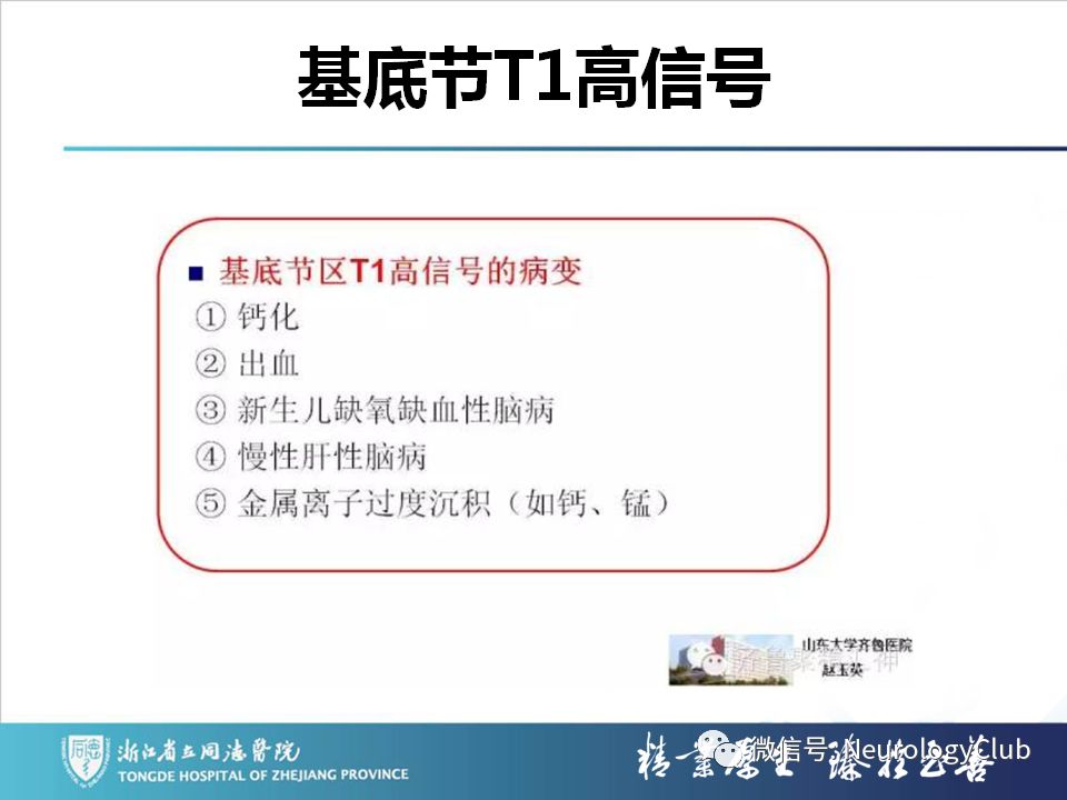 影像PPT - 【PPT】双侧基底节病变的影像诊断和鉴别诊断-203