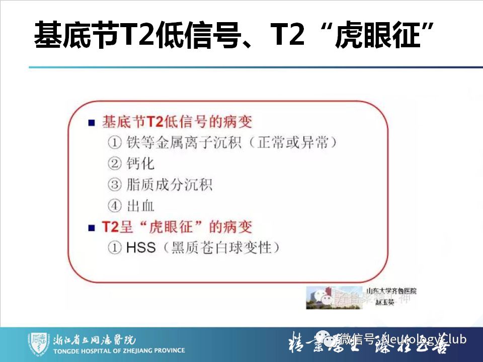 影像PPT - 【PPT】双侧基底节病变的影像诊断和鉴别诊断-204