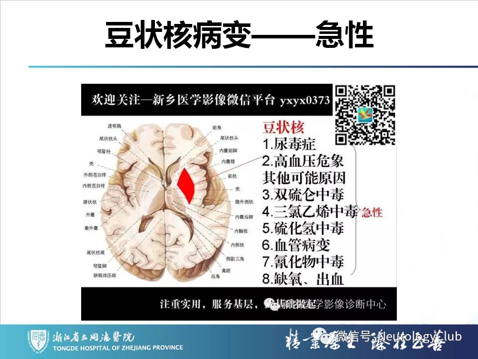 影像PPT - 【PPT】双侧基底节病变的影像诊断和鉴别诊断-217