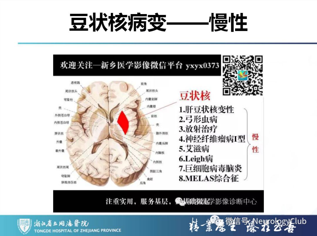 影像PPT - 【PPT】双侧基底节病变的影像诊断和鉴别诊断-218