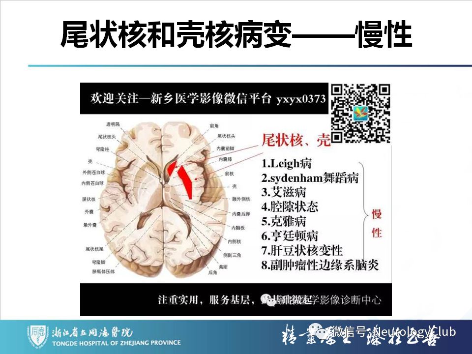 影像PPT - 【PPT】双侧基底节病变的影像诊断和鉴别诊断-222