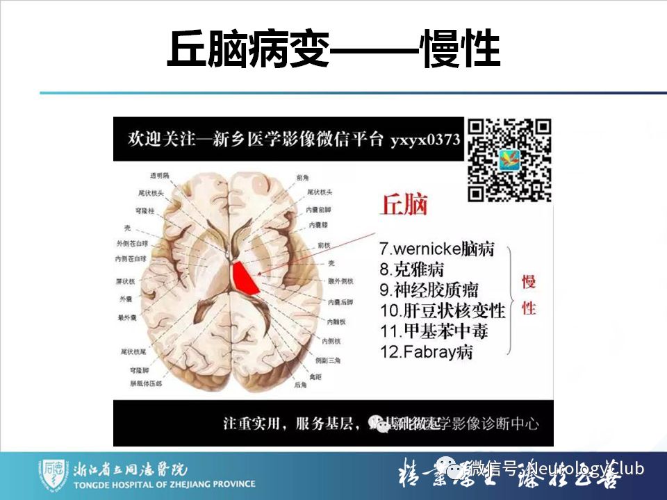 影像PPT - 【PPT】双侧基底节病变的影像诊断和鉴别诊断-224