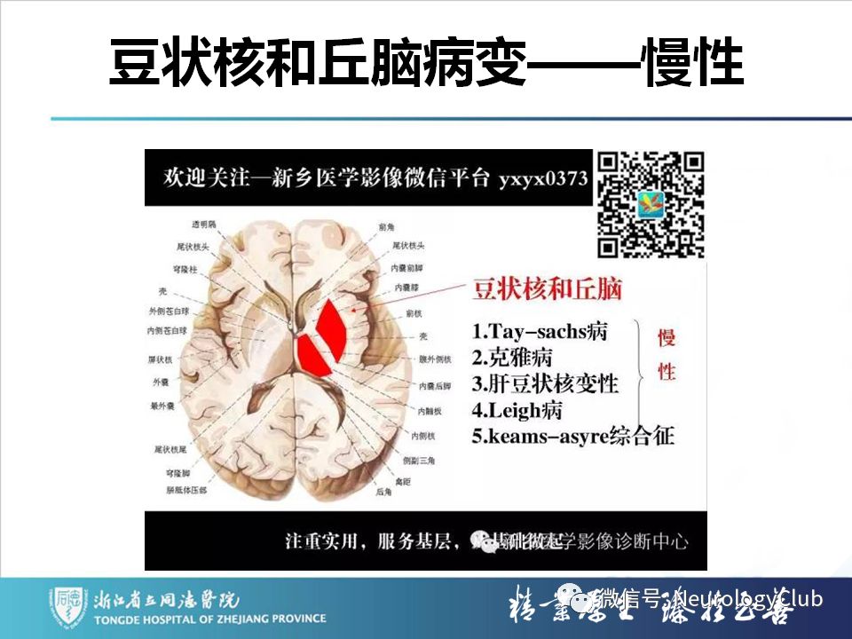 影像PPT - 【PPT】双侧基底节病变的影像诊断和鉴别诊断-225