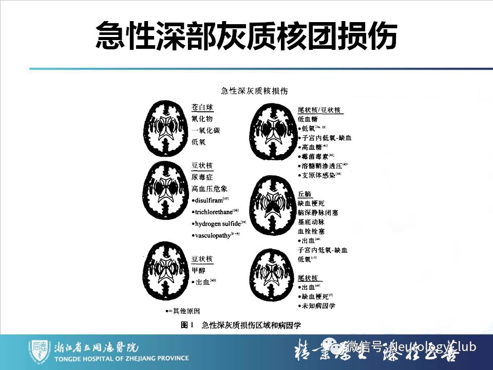 影像PPT - 【PPT】双侧基底节病变的影像诊断和鉴别诊断-228