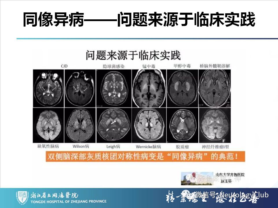 影像PPT - 【PPT】双侧基底节病变的影像诊断和鉴别诊断-230