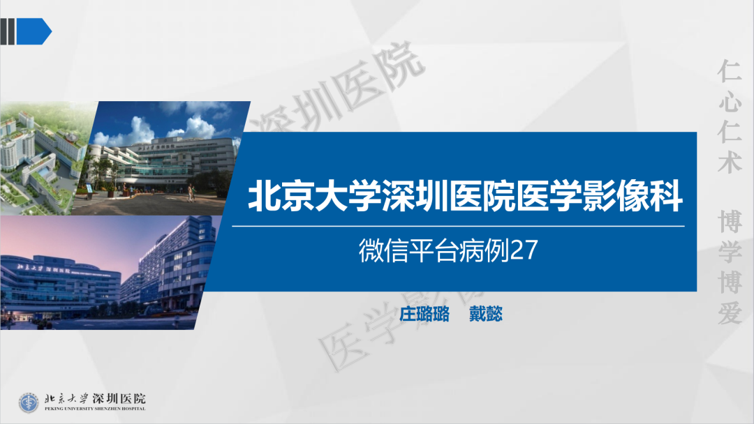 影像PPT - 【PPT】遗传性出血性毛细血管扩张症-1