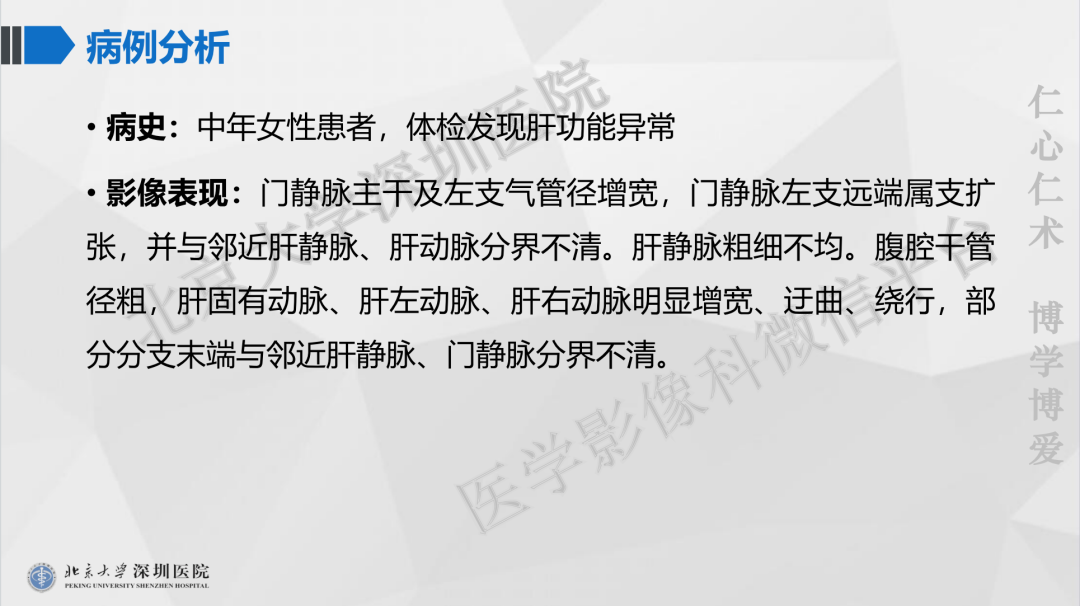 影像PPT - 【PPT】遗传性出血性毛细血管扩张症-11