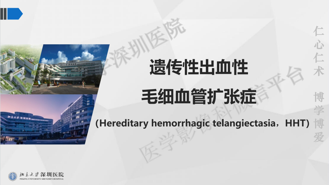 影像PPT - 【PPT】遗传性出血性毛细血管扩张症-14