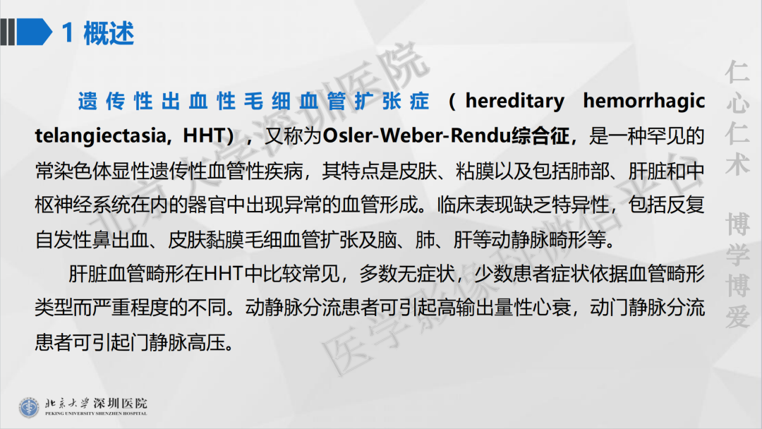 影像PPT - 【PPT】遗传性出血性毛细血管扩张症-17
