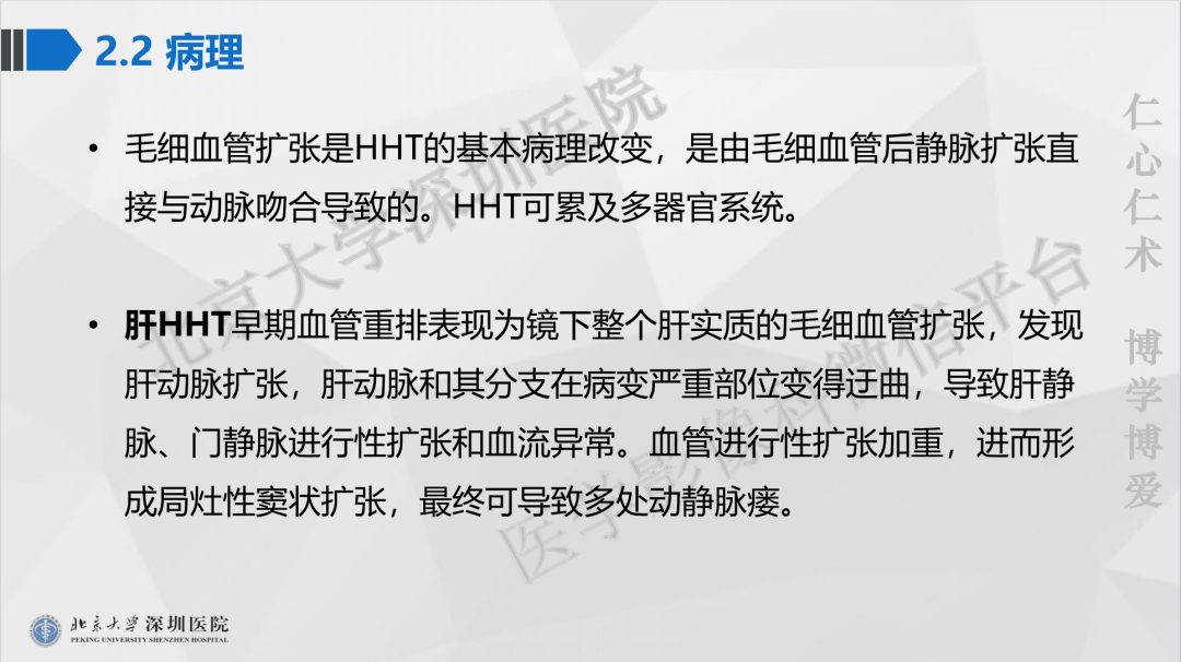 影像PPT - 【PPT】遗传性出血性毛细血管扩张症-23