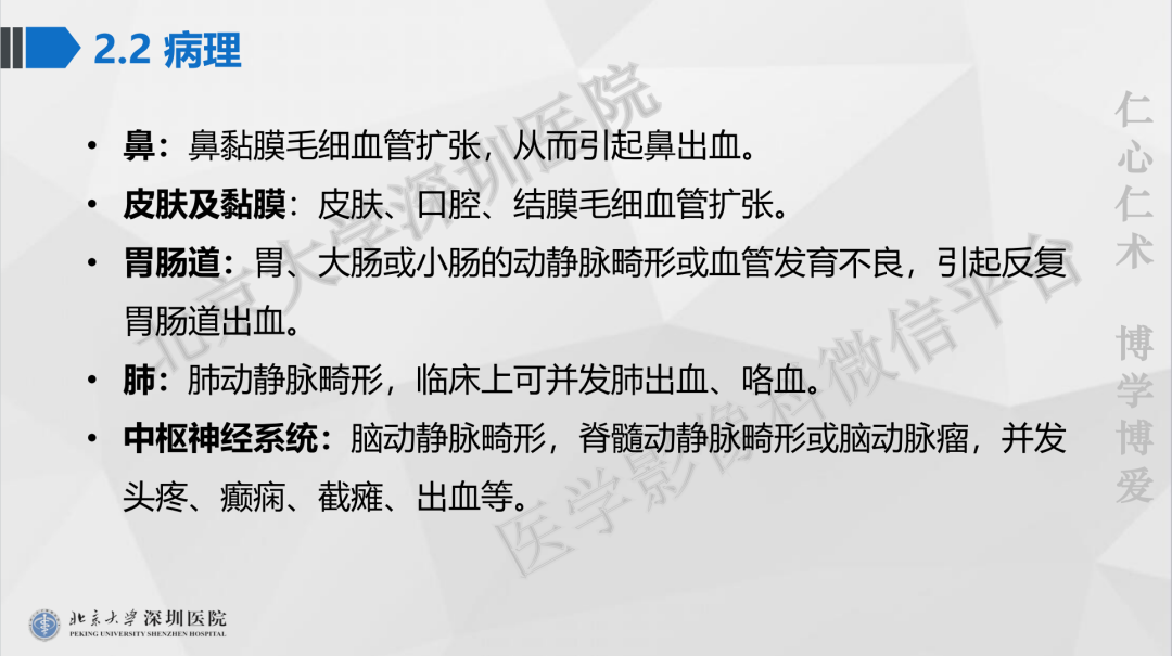 影像PPT - 【PPT】遗传性出血性毛细血管扩张症-24