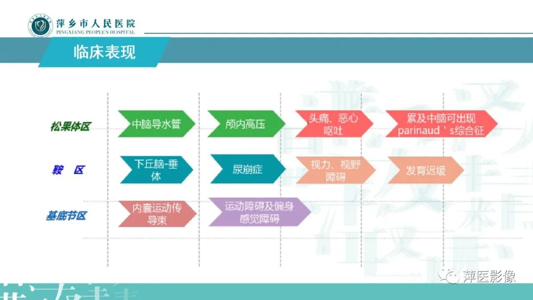 影像PPT - 【PPT】颅内生殖细胞瘤影像表现及鉴别诊断-4