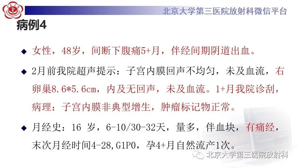 影像PPT - 【PPT】子宫内膜异位症和子宫腺肌症-10