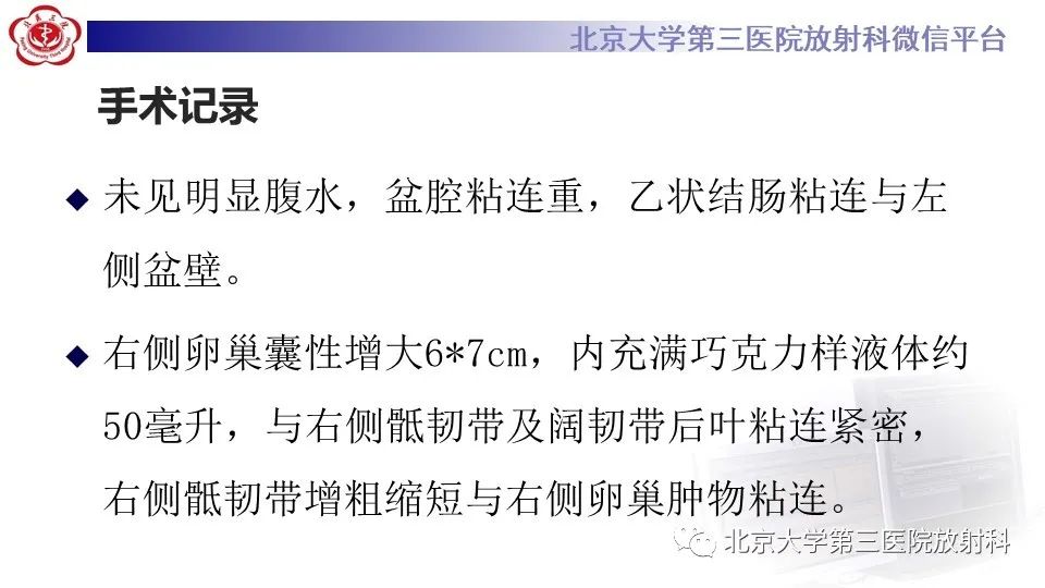 影像PPT - 【PPT】子宫内膜异位症和子宫腺肌症-14