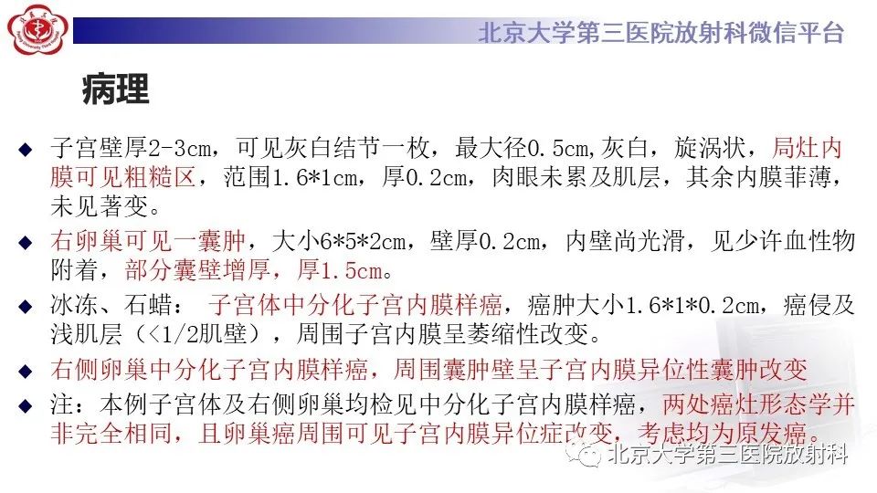 影像PPT - 【PPT】子宫内膜异位症和子宫腺肌症-15