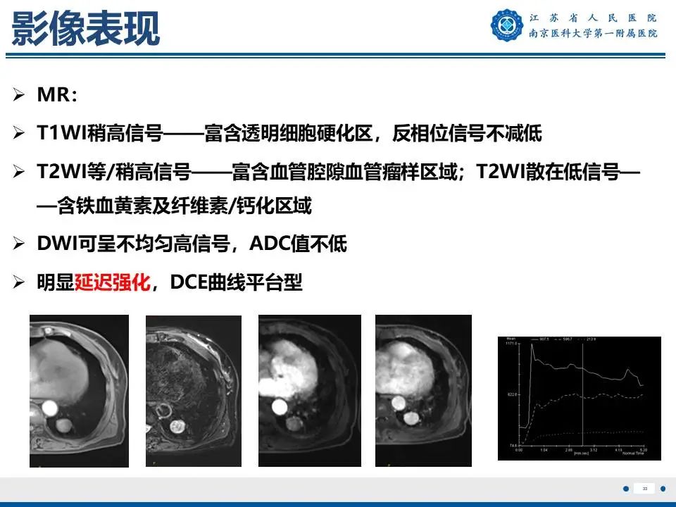 影像PPT - 【PPT】肺硬化性肺泡细胞瘤-34