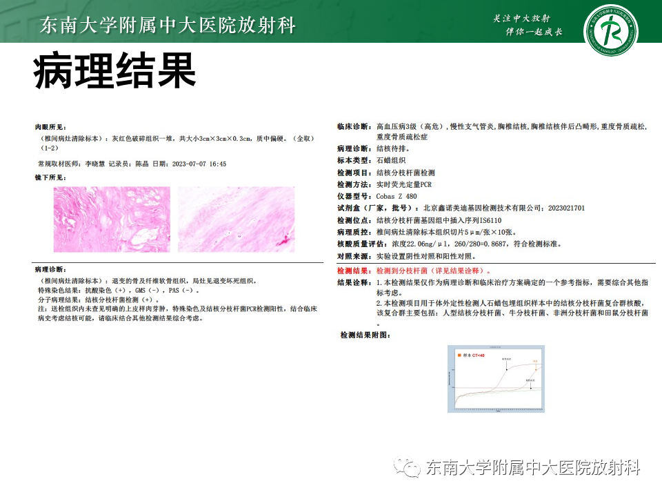 影像PPT - 【PPT】脊柱结核影像诊断-3 影像PPT - 【PPT】脊柱结核影像诊断-3