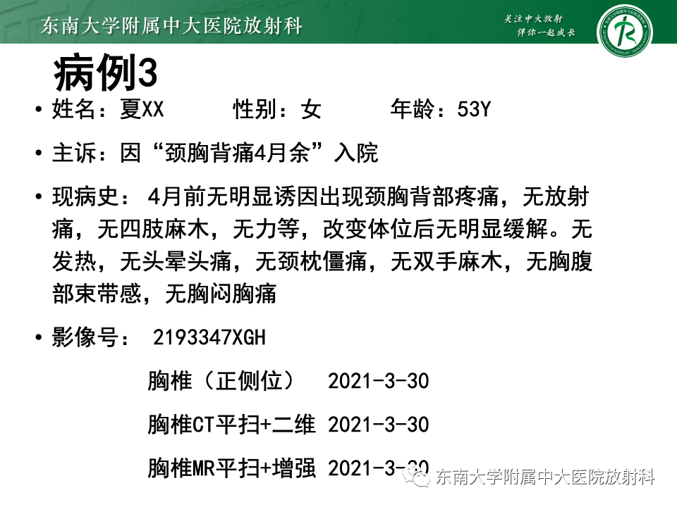 影像PPT - 【PPT】脊柱结核影像诊断-21 影像PPT - 【PPT】脊柱结核影像诊断-21