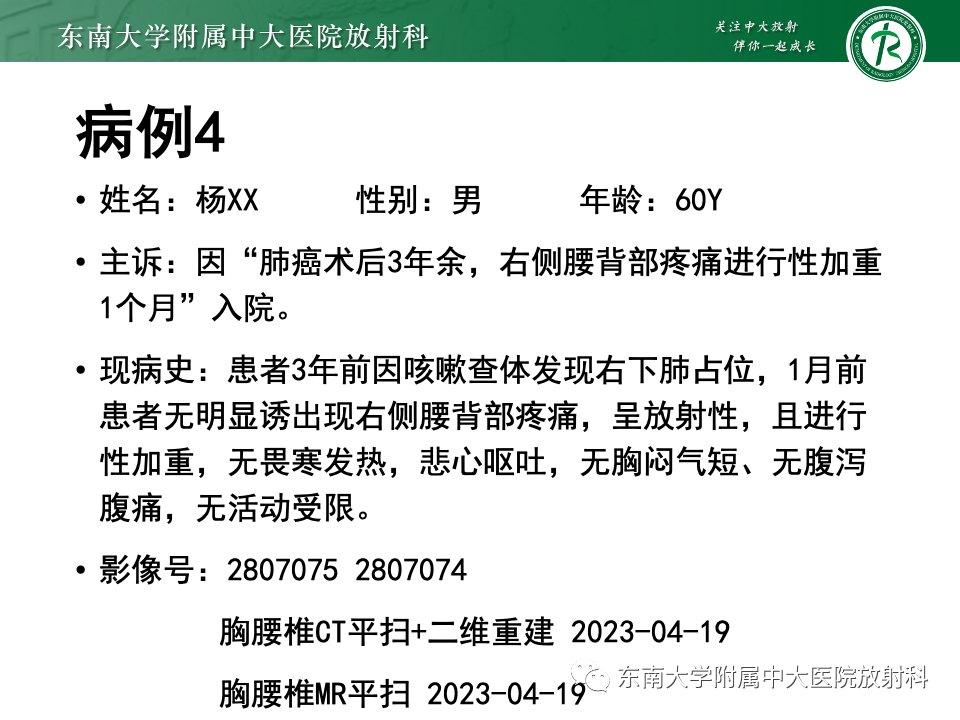 影像PPT - 【PPT】脊柱结核影像诊断-26 影像PPT - 【PPT】脊柱结核影像诊断-26
