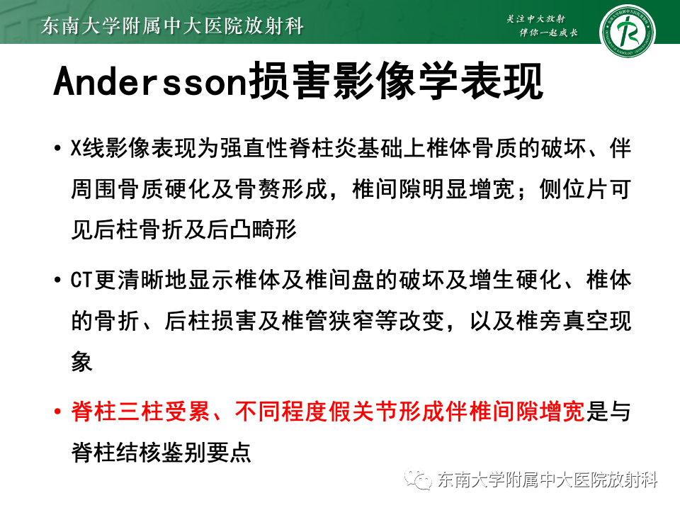 影像PPT - 【PPT】脊柱结核影像诊断-33 影像PPT - 【PPT】脊柱结核影像诊断-33
