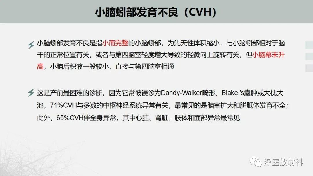 影像PPT - 【PPT】胎儿和新生儿后颅窝畸形的影像诊断-21