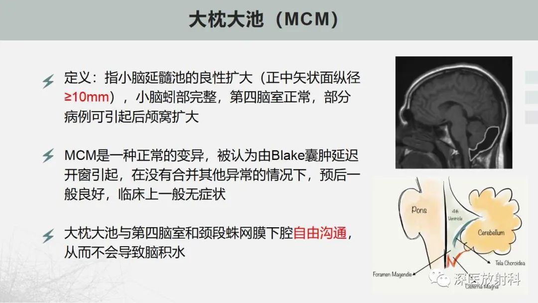影像PPT - 【PPT】胎儿和新生儿后颅窝畸形的影像诊断-23