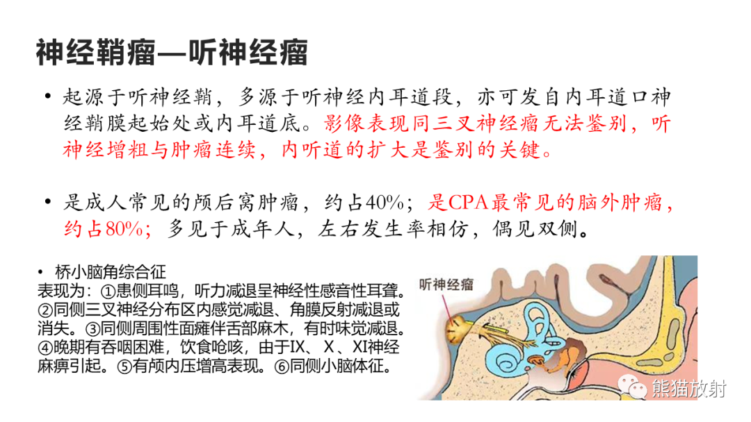 影像PPT - 【PPT】桥小脑角区CPA脑膜瘤 VS 神经鞘瘤-25