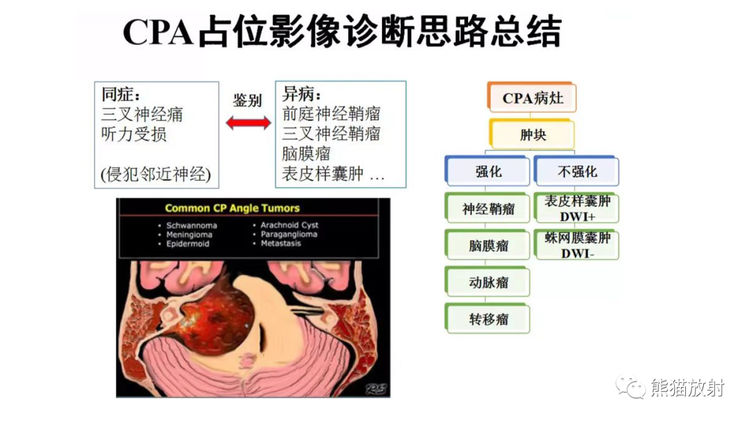 影像PPT - 【PPT】桥小脑角区CPA脑膜瘤 VS 神经鞘瘤-34