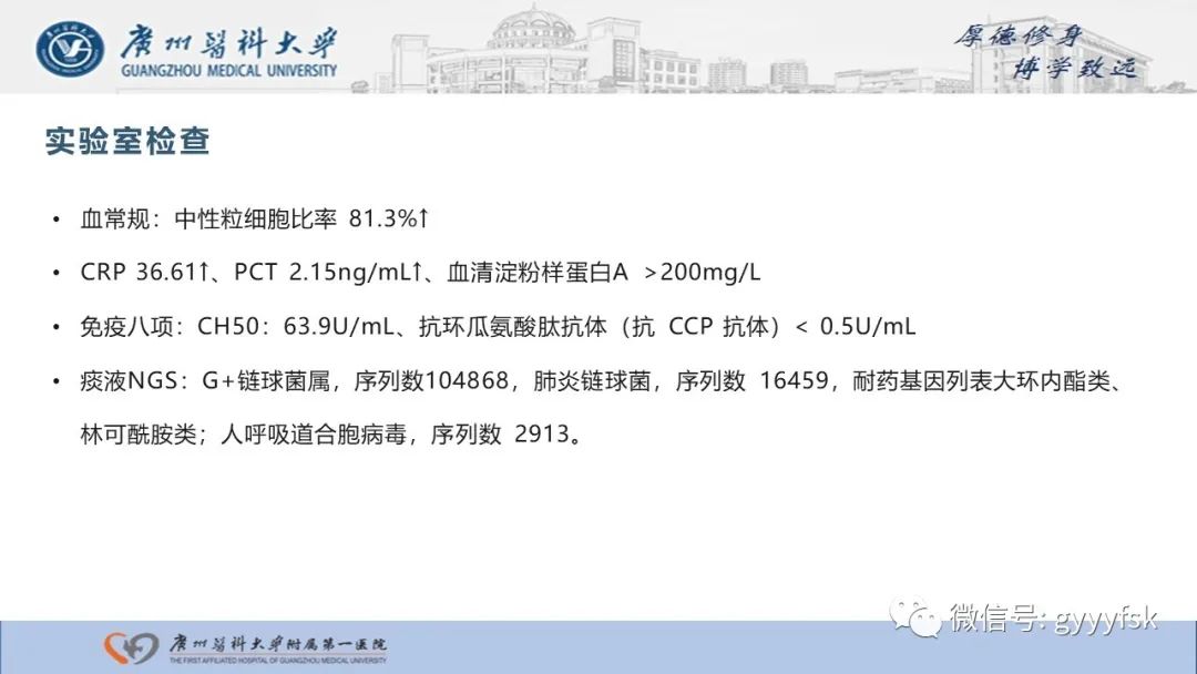 影像PPT - 【病例】复发性多软骨炎1例CT影像-3