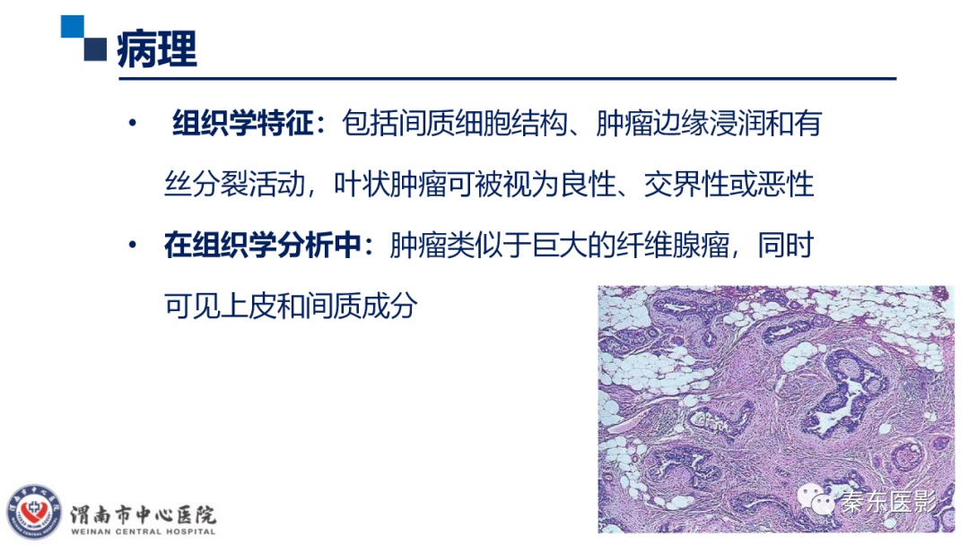 影像PPT - 【PPT】乳腺叶状肿瘤的影像表现-19