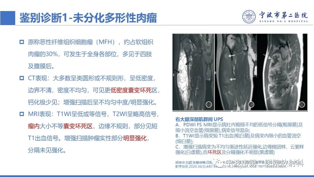 影像PPT - 【PPT】增生性肌炎-27