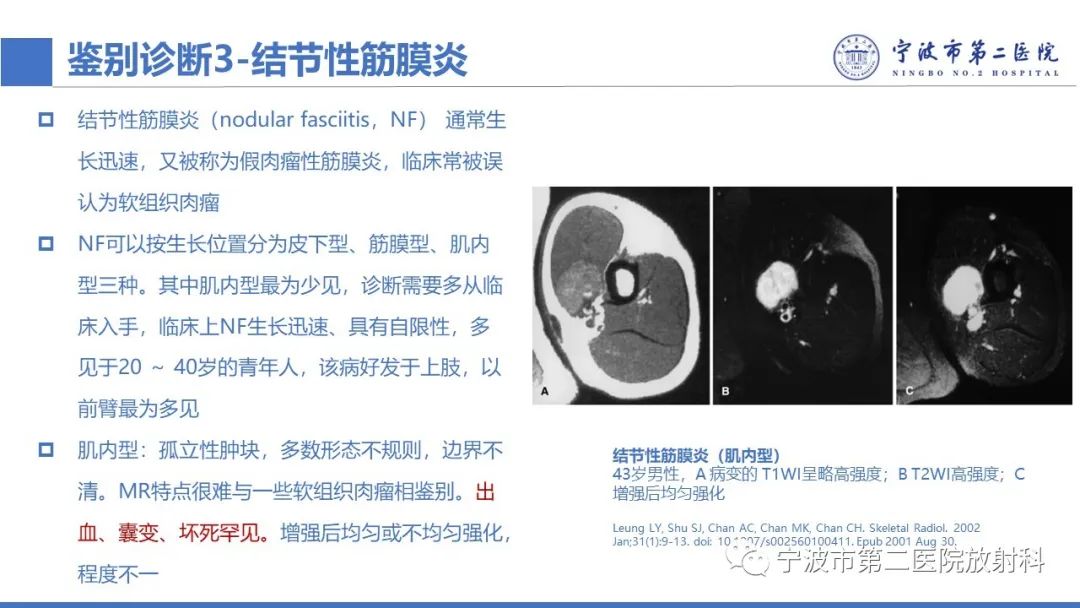 影像PPT - 【PPT】增生性肌炎-29