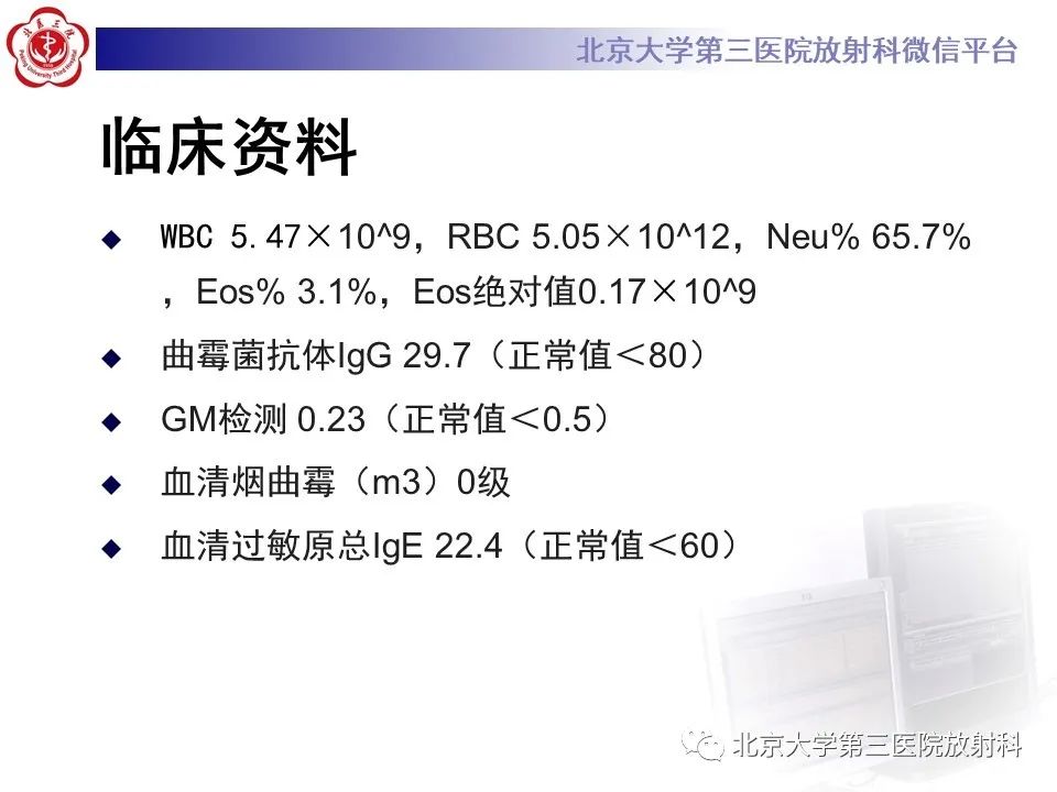 影像PPT - 【PPT】小细胞肺癌-3