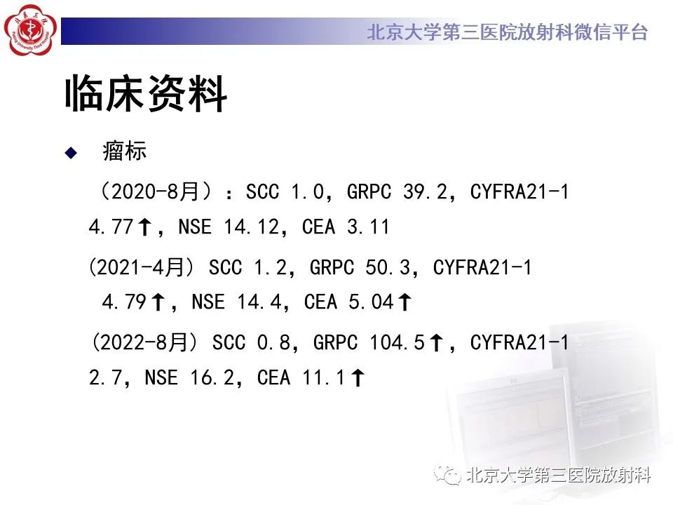 影像PPT - 【PPT】小细胞肺癌-4