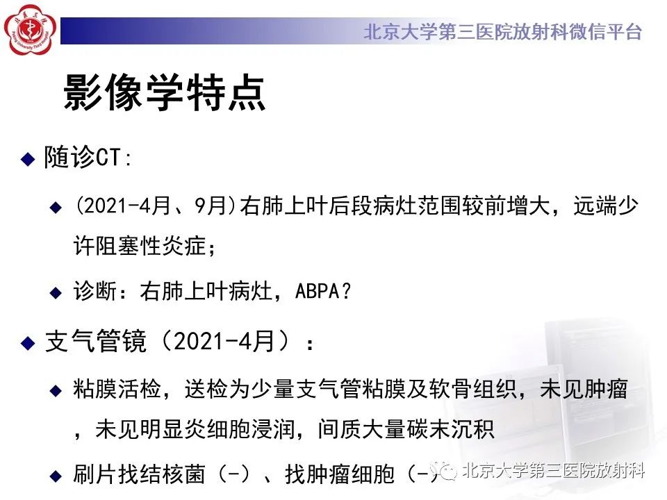影像PPT - 【PPT】小细胞肺癌-13