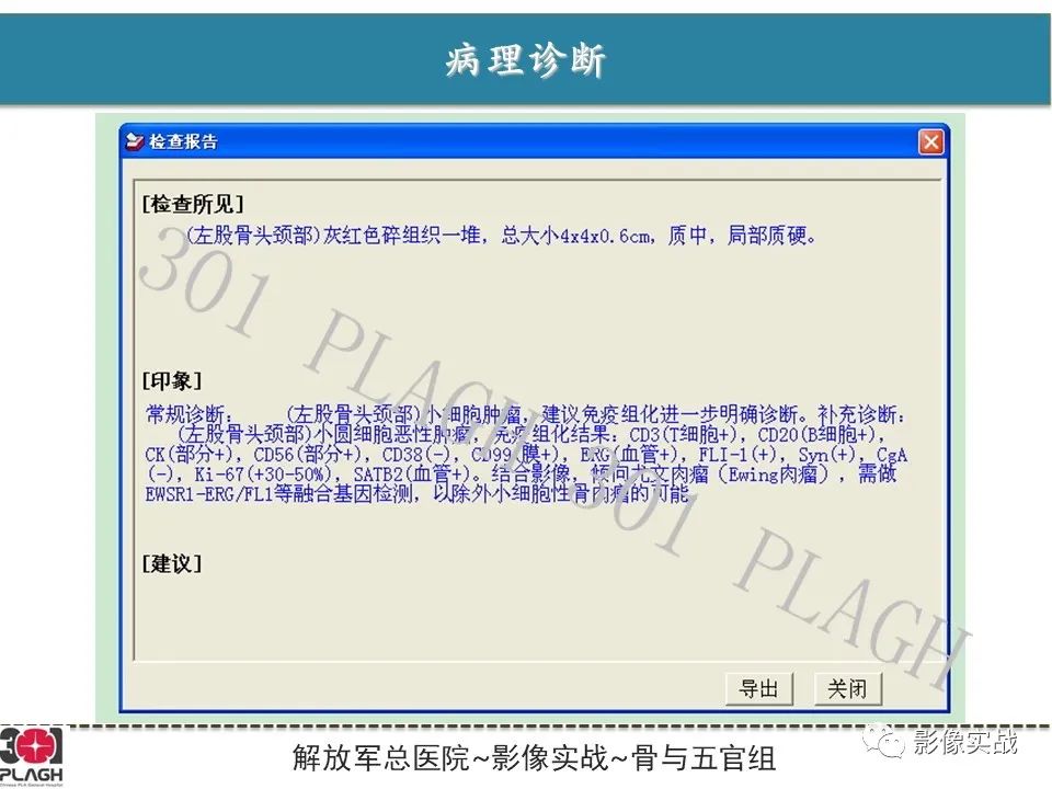 影像PPT - 【病例】股骨尤文氏肉瘤1例X线MR影像-13