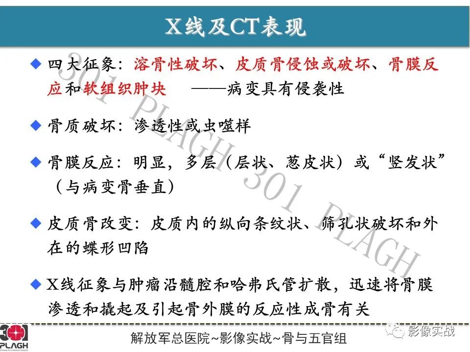 影像PPT - 【病例】股骨尤文氏肉瘤1例X线MR影像-16
