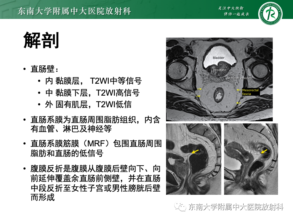 影像PPT - 【PPT】直肠癌影像学诊断与分期-5