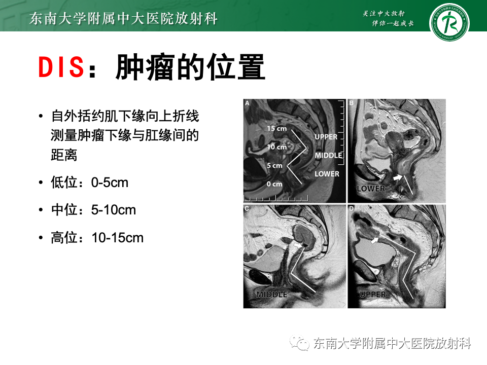 影像PPT - 【PPT】直肠癌影像学诊断与分期-15