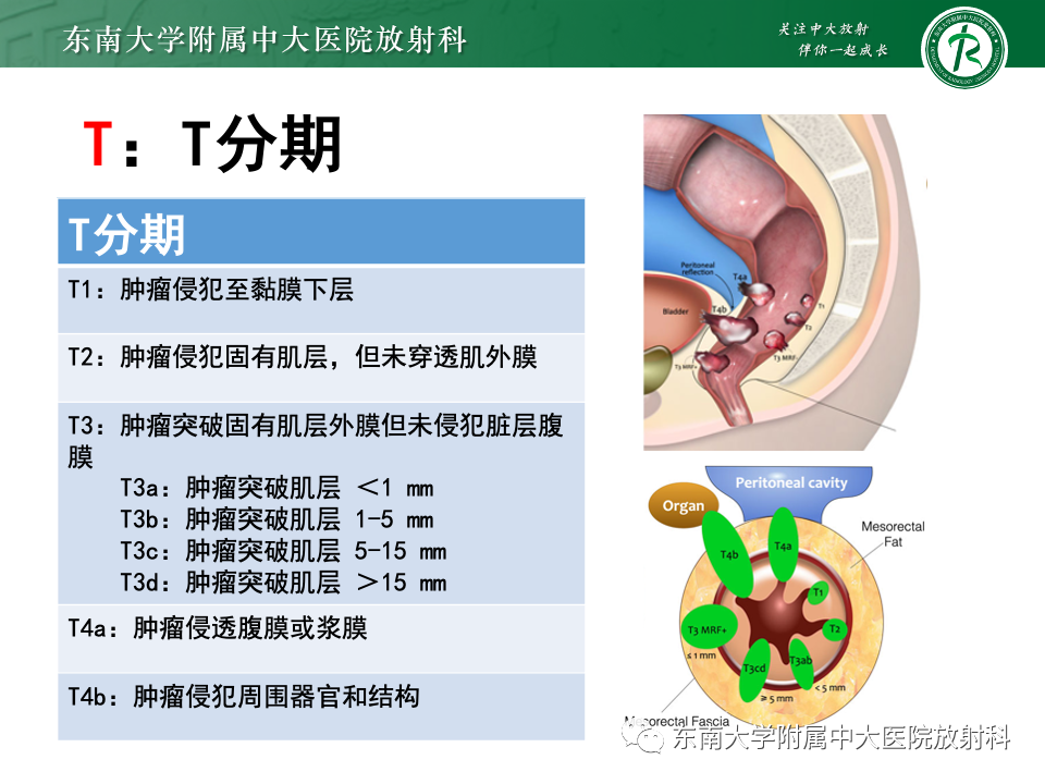 影像PPT - 【PPT】直肠癌影像学诊断与分期-17