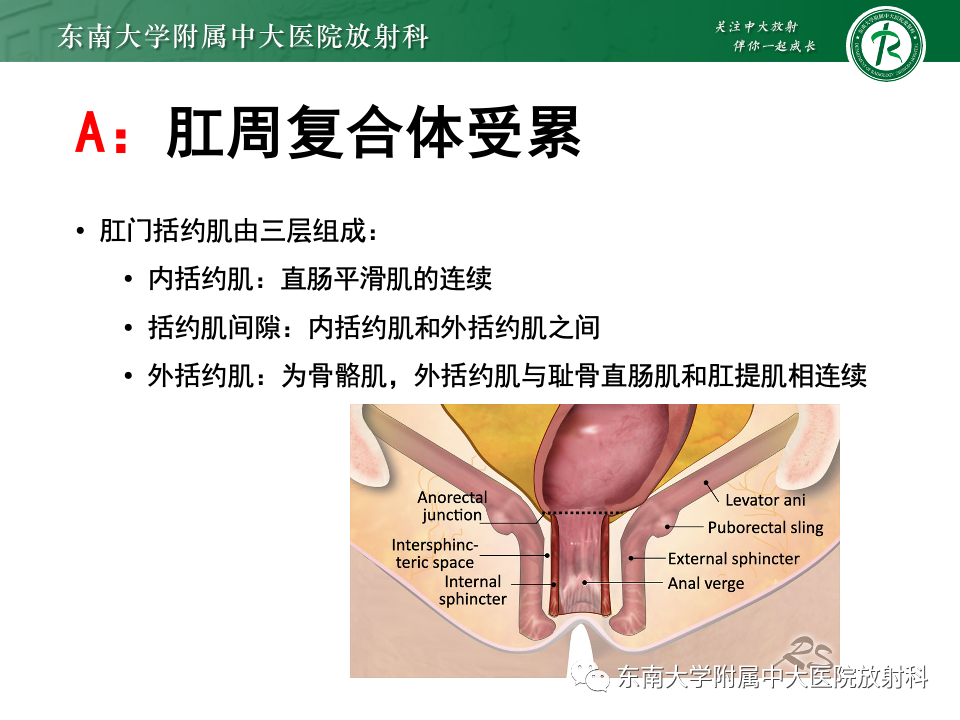 影像PPT - 【PPT】直肠癌影像学诊断与分期-23