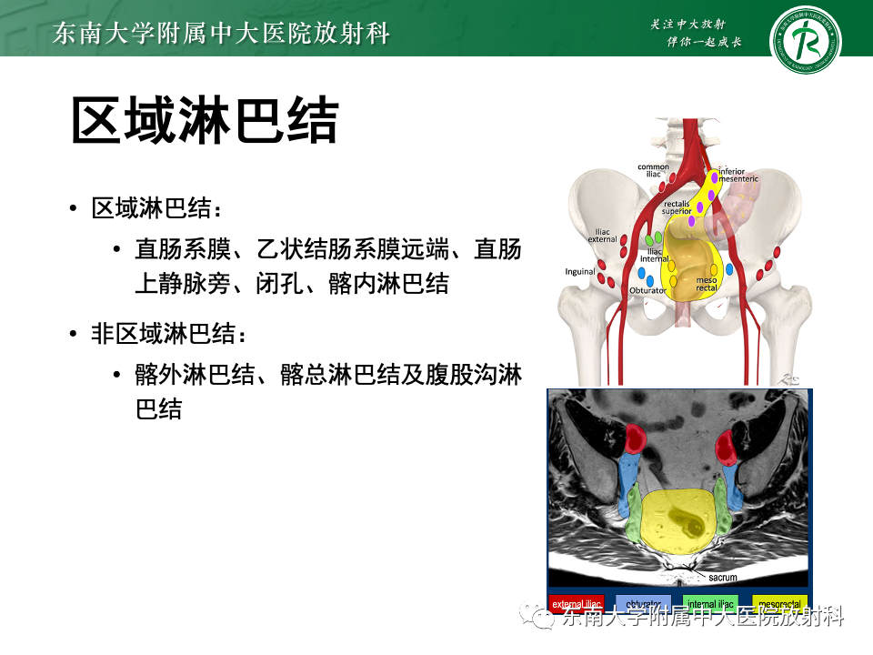 影像PPT - 【PPT】直肠癌影像学诊断与分期-26