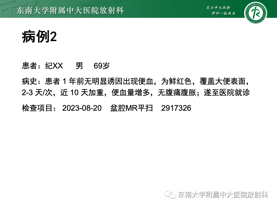 影像PPT - 【PPT】直肠癌影像学诊断与分期-31