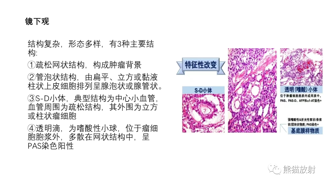 影像PPT - 【病例】腹膜后肾上腺区卵黄囊瘤1例CT影像-13