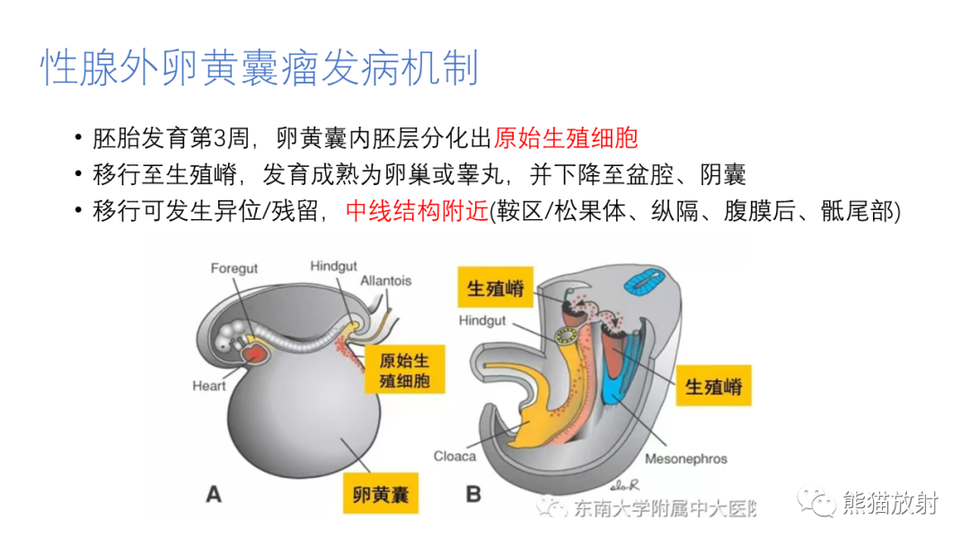 影像PPT - 【病例】腹膜后肾上腺区卵黄囊瘤1例CT影像-15
